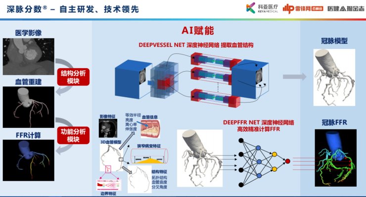 功能学|科亚医疗曹坤琳：合规认证、数据集建设，医疗AI首证背后的经验全盘点