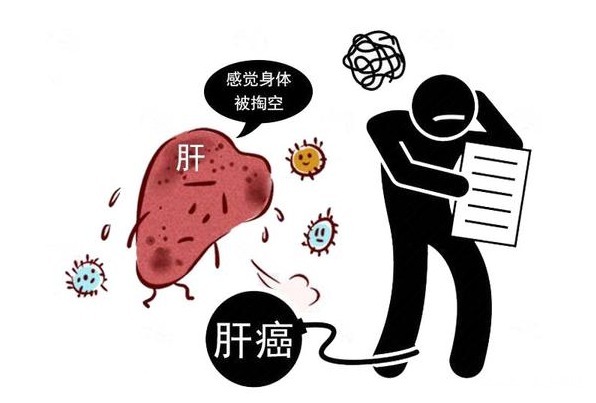 中老年人|体内有癌,腹部先露出破绽,这3种症状,切莫大意!