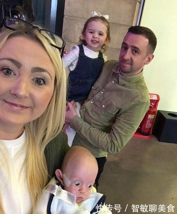 宝宝|英国妇女在怀孕21周时生下一个孩子宝宝是透明的,可以看到体内的血液流动