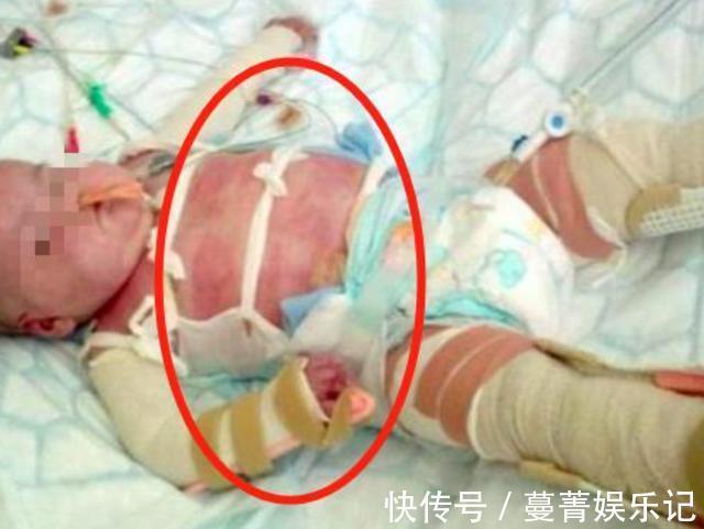 干燥剂|下雪天妈妈出门买菜,刚出生宝宝在家熟睡,回来时孩子已面目全非