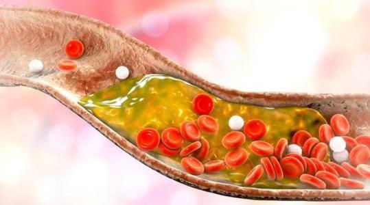 血脂异常|晚上睡觉如果出现以下四种表现,八成是血脂过高,及时去医院检查