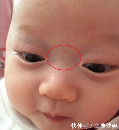 积食|如果宝宝发出7种表现,说明是身体“积食”了,家长别忽视