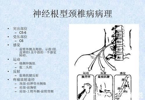 脊髓|什么是颈椎病，对照这些症状，看看你有没有中招