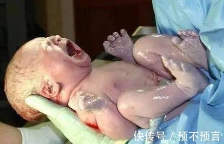 避孕环|宝宝贴着避孕环出生,医生说发育受影响,上幼儿园后才知道真相