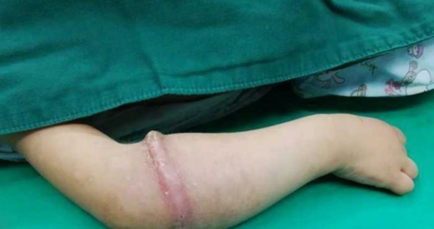 手臂疼|三岁女孩一直说手臂疼,送到医院检查后,医生说你们差点后悔一生