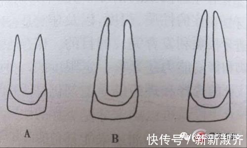 坏死|牙医姐姐讲故事︱断牙如何修补?别让意外“折”了童年的欢乐