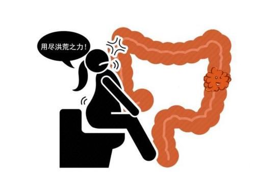 癌肿|晨起一个症状，可能是肠癌“征兆”，很多人都忽视了！