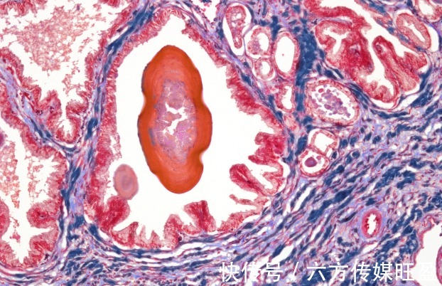 白瓜子|20岁男子前列腺炎入院，差点不育，医生：常做2事前列腺顶不住