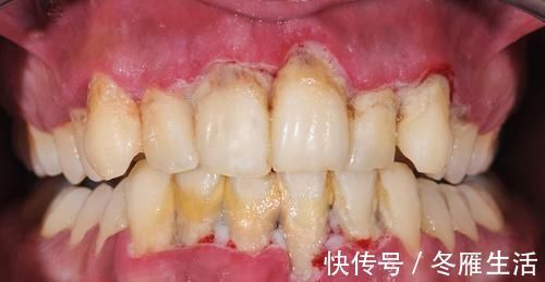 牙周|农村治牙痛的奇怪办法,1块生姜就能搞定,1分钟见效,值得一试