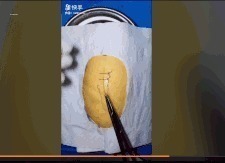 王醫生|32歲醫生竟給水果做手術？一夜吸粉12萬！網友：“我的膝蓋跪爛了”