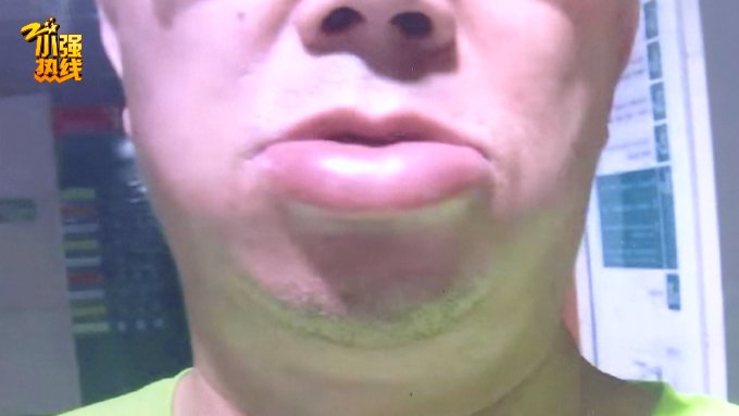 现代途胜|新车开了一个月，男子感觉要窒息：舌头比原来大了4倍