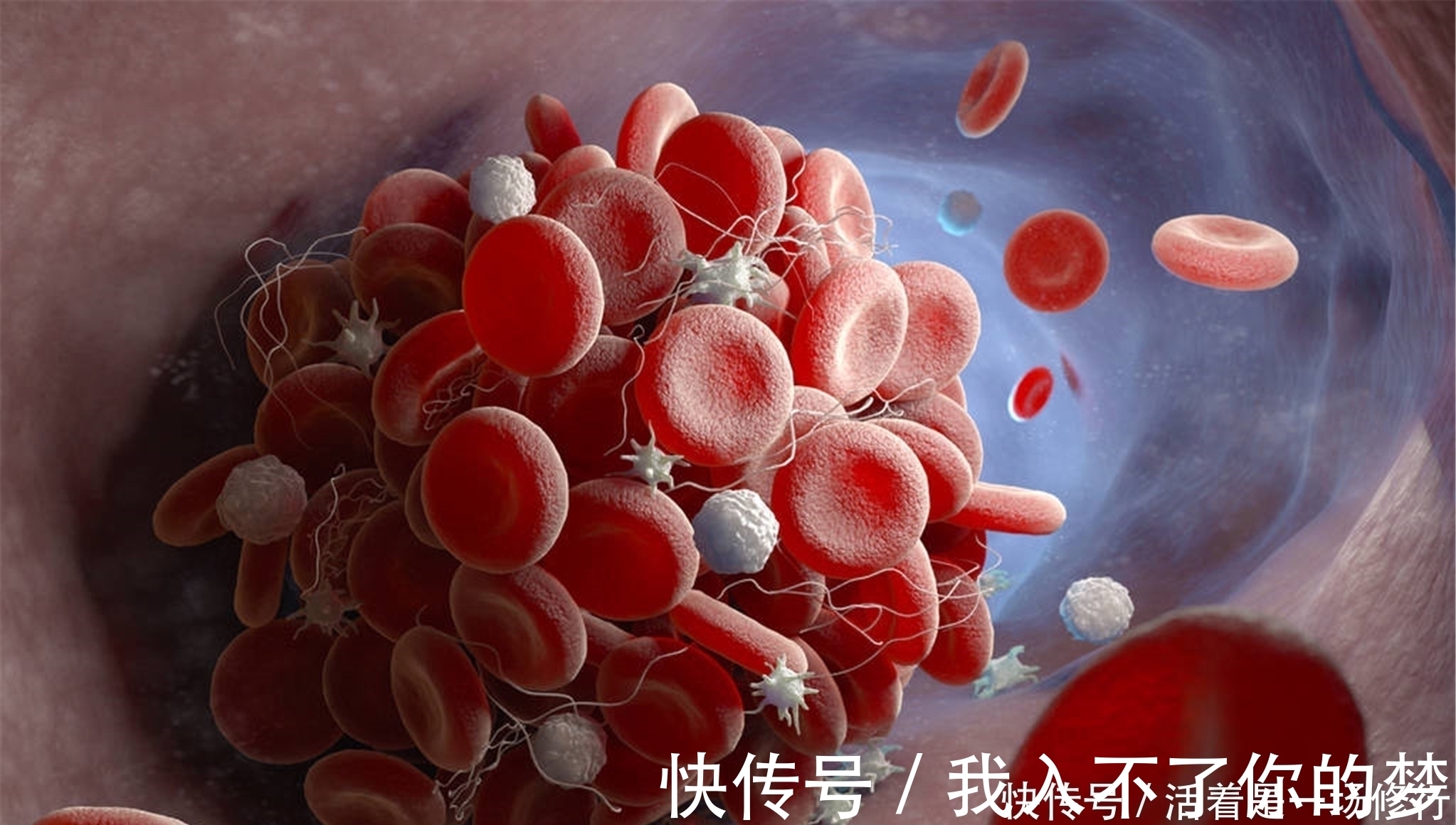 泡水|陈皮和它“天生一对”，泡水喝点，健脾养肝，血管干净不堵塞