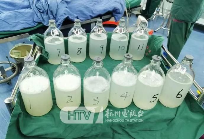 牛奶|杭州有人肺里洗出11瓶“牛奶”！这些情况要注意→