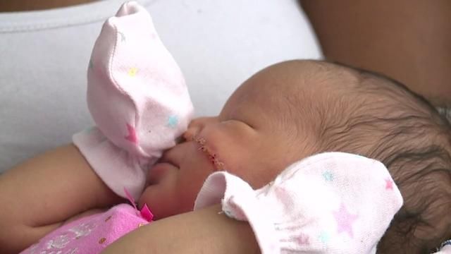 电视台|出生就毁容了？美国一新生儿剖腹产手术中被割伤，脸上被缝13针