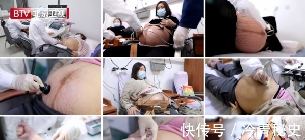 魔法|北京卫视《生命缘》第十一季暖心回归:每一个她,都有爱的“魔法”