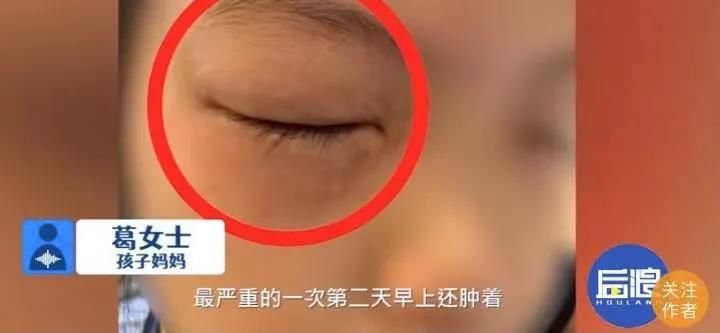 杨国军|怪事！一到学校就呕吐，一做数学题眼睛就过敏，他们怎么了......