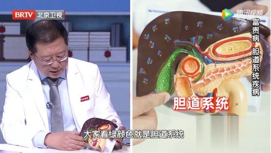 胆固醇结石|胆结石喜欢找上3类人，有这个坏习惯更易中招！看看有没有你~