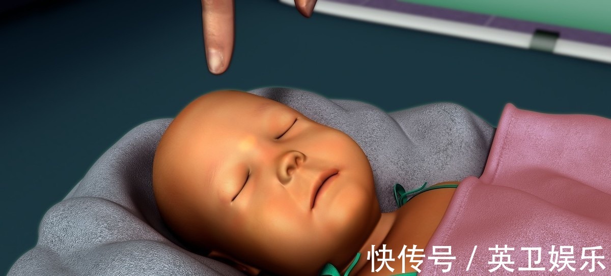 肝功能|手掌胸部出现这些表现,立即去医院查查肝,是肝硬化的前期表现