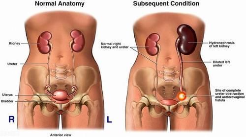 中医师|养肾其实不难！中医师：按3个穴位，吃3样东西，每天10分钟足矣