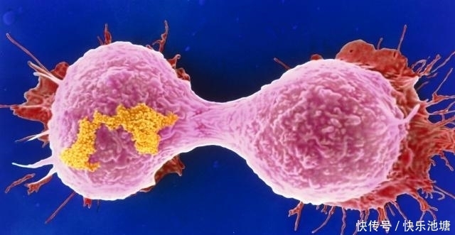 为何癌症越来越年轻化?这3物或许是罪魁祸首,希望你早点远离!