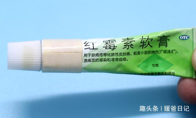 红霉素软膏|红霉素软膏除了药用,还有5个妙用也很棒,叮嘱家人知道,很实用