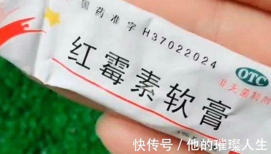 美白|红霉素软膏加它涂抹脸部,不出15天淡斑又美白,赶紧去备上一支!