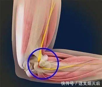 手部麻木的7种常见病因、如何鉴别及治疗