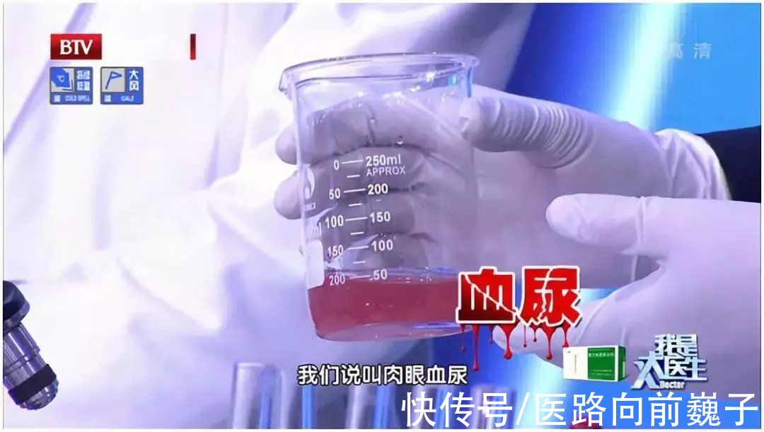 急性肾损伤|浙江6人吃了它后肾坏掉!这种"长寿菜"味鲜美,很多人爱吃...扩散