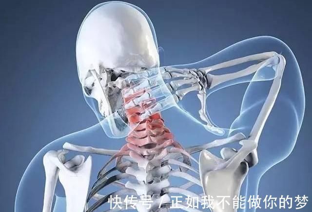 治疗|颈椎病“病在颈椎，伤在全身”，教你一个自我治疗绝活，马上搞起