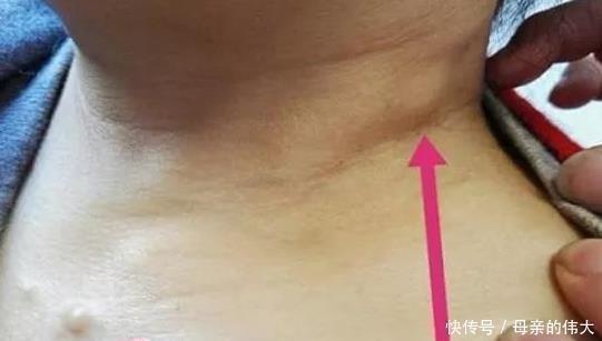 男女|肿瘤医生不论男女,当皮肤有这“反常”,癌症已大肆张扬