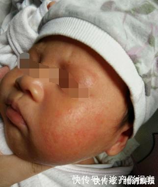 漂亮|怀孕期间想要宝宝白净漂亮,不长胎毒和黄疸,注意以下几点