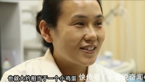 夫妻两人|1.6米孕妇生下五胞胎,最小的孩子只有鸡蛋那么点大,孩子命悬一线