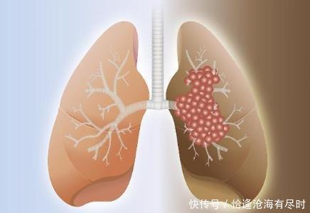 烟民|此物是尼古丁的“小冤家”,20年的老烟民常吃点,肺可以轻松一些