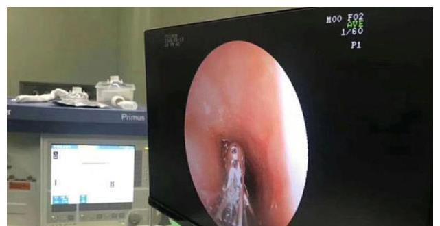 父母|男孩胃里发现一团“胶”,父母眼中的好零食,制作环境堪比垃圾场