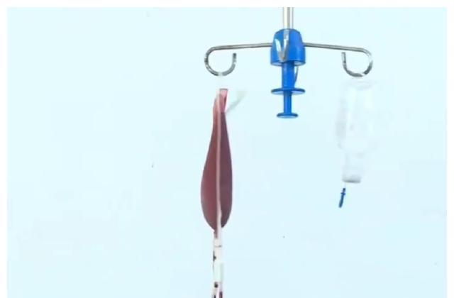 大肚子|38岁女人4年怀9次孕,3次引产,6次流产,她的故事很动人