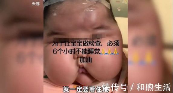 宝宝|10万销量的宝宝霜检出强效激素,宝宝的吃穿用如何保障安全?