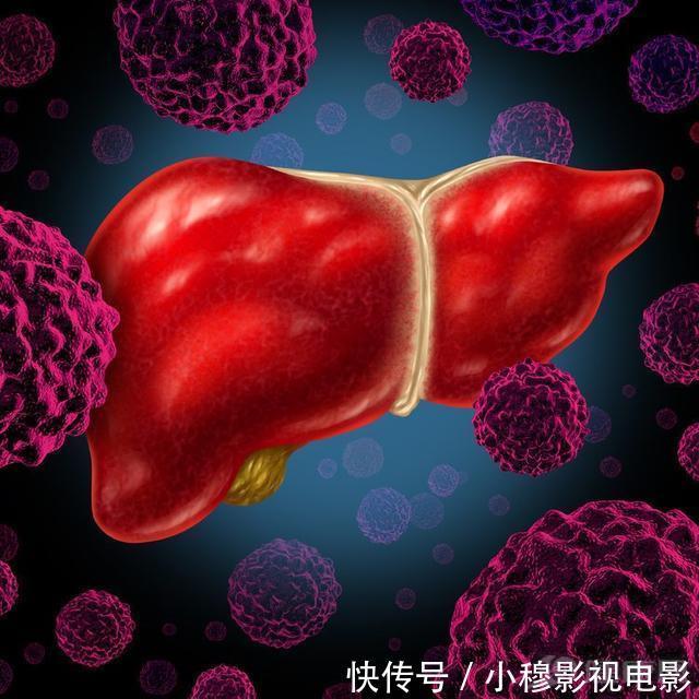 医生|如果你不想得肝癌，请记好这三句话！医生一般都不说