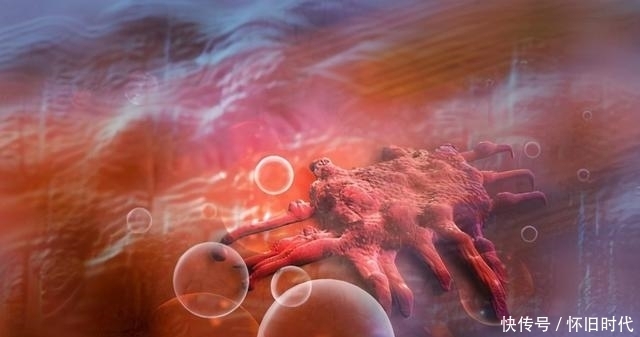 普志东:查出癌症,如何做到不恐慌?