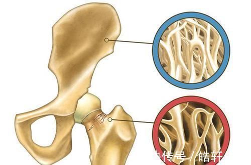 补钙|中老年人预防骨质疏松,光补钙还不够?加上2种营养,事半功倍