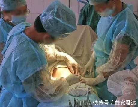 麻醉剂|什么是备皮？什么是小牛奶？了解这些产房暗语，避免尴尬