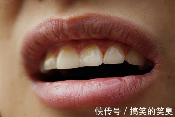 胸闷|血管堵了,身体会发出“求救信号”,晚上会比较明显