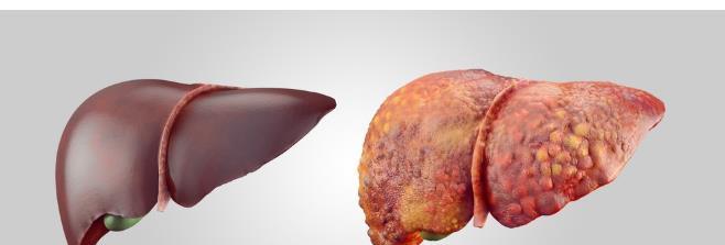 酒精|喝酒做到這6點,不但不易醉,還能保護肝臟!能喝酒的都知道