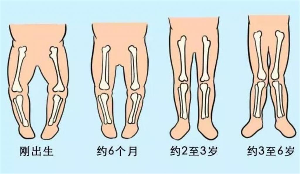 无缘|孩子爱用这3种坐姿,基本无缘“大长腿”,还影响气质,尽早纠正