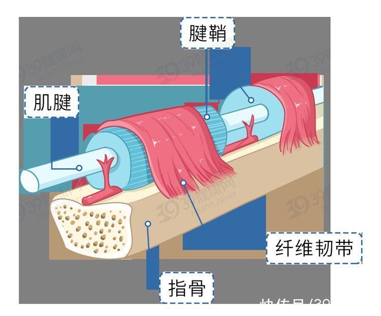 折磨|常年折磨女性的腱鞘炎，是怎么产生的？如何治疗？告诉你详细方法