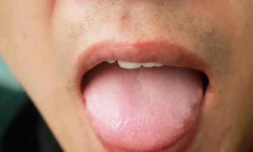 五脏健康都写在舌头上了，舌苔厚重、发黄究竟是怎么回事？