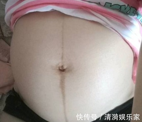 产检|前几次产检没问题,孕晚期却查出胎儿畸形,过了这个阶段才能放心