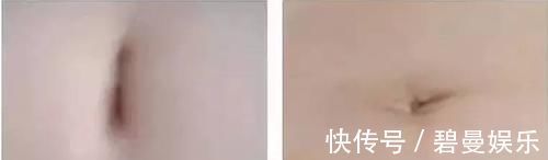十二根肋骨的位置图片 十二根肋骨的位置图片