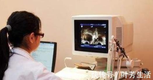 检查|女性体检的时候,5个项目是“必查项”,别再舍不得花钱!