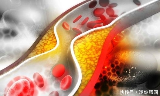 医生提醒:血管不通的人,晚上睡觉会有3个现象,最好别忽视!