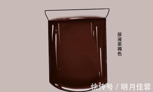 气味|一个人若肝不好，上厕所时会有怪象出现，占得多，暗示肝受损严重